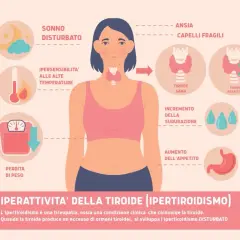 Sintomi tiroide nelle donne: sonno disturbato, ansia, perdita di peso, sudorazione, aumento appetito, ipersensibilità al caldo, capelli fragili.