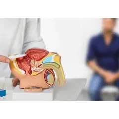 Modello anatomico mostra la prostata. Un medico spiega le opzioni di trattamento, inclusa la radioterapia per la guarigione.