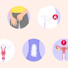 Illustrazioni di sintomi ginecologici, tra cui prurito, infiammazione, dolore e perdite. Possibili funghi in gravidanza.