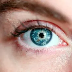 Occhio azzurro con iride dettagliata. Potrebbe essere un caso di cataratta giovanile, che rende l'occhio opaco.