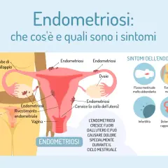 Illustrazione anatomica dell'utero e delle ovaie che mostra la crescita di tessuto endometriale fuori dall'utero, con i principali sintomi dell'endometriosi: flusso abbondante, dolori mestruali, infertilità e dolore durante i rapporti sessuali.