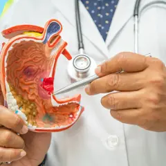 Modello anatomico dello stomaco, con un dito che indica un'area che potrebbe rappresentare una gastropatia antrale.