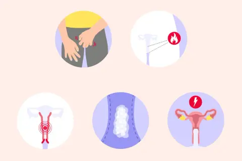 Illustrazioni di sintomi ginecologici, tra cui prurito, infiammazione, dolore e perdite. Possibili funghi in gravidanza.