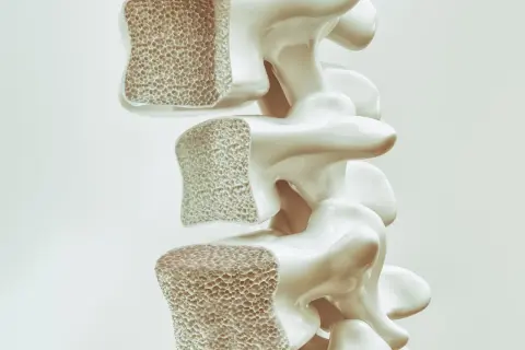 Sezione di vertebre con osso spugnoso. Prolia a cosa serve: aiuta a rafforzare le ossa fragili, contrastando l'osteoporosi.
