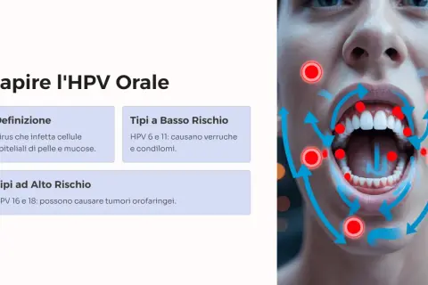 Il papilloma virus può causare tumori alla gola. L'HPV ad alto rischio, come i tipi 16 e 18, è associato a tumori orofaringei.