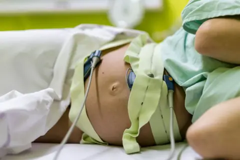 Pancia di donna incinta con monitoraggio per il parto indotto. Le fasce verdi e i sensori sono posizionati per monitorare il battito cardiaco del feto.