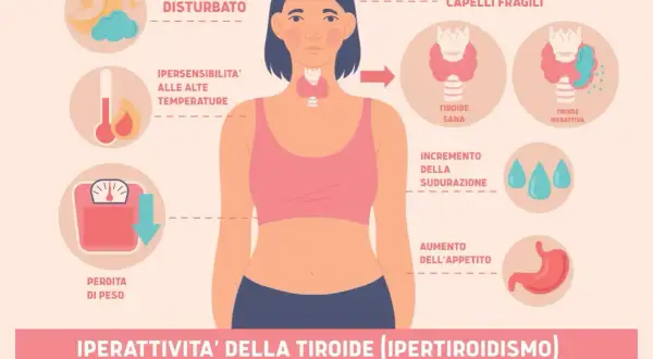 Sintomi tiroide nelle donne: sonno disturbato, ansia, perdita di peso, sudorazione, aumento appetito, ipersensibilità al caldo, capelli fragili.