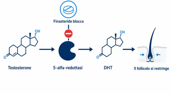 Schema che illustra come la finasteride blocca la 5-alfa-reduttasi, riducendo il DHT e prevenendo il restringimento del follicolo. Possibili finasteride effetti collaterali legati a questo meccanismo.