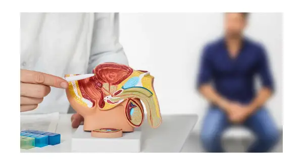 Modello anatomico mostra la prostata. Un medico spiega le opzioni di trattamento, inclusa la radioterapia per la guarigione.
