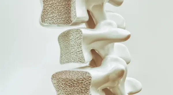Sezione di vertebre con osso spugnoso. Prolia a cosa serve: aiuta a rafforzare le ossa fragili, contrastando l'osteoporosi.