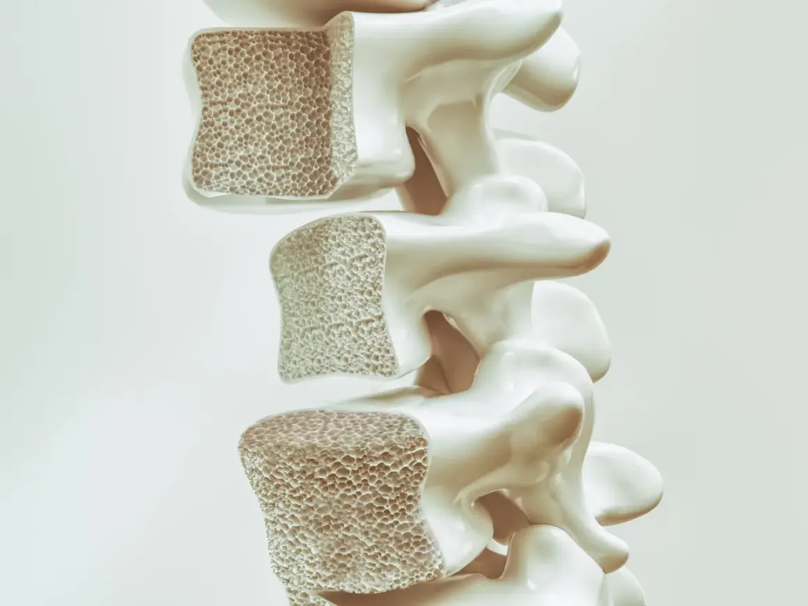 Sezione di vertebre con osso spugnoso. Prolia a cosa serve: aiuta a rafforzare le ossa fragili, contrastando l'osteoporosi.