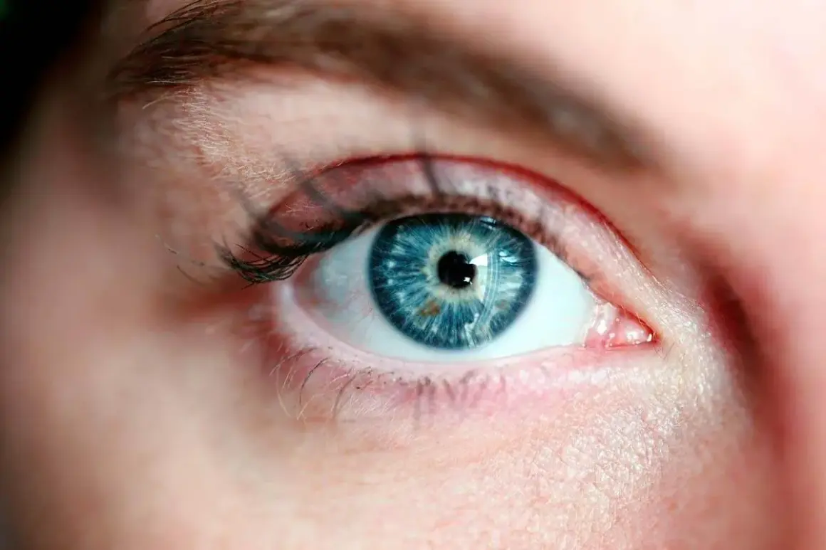 Occhio azzurro con iride dettagliata. Potrebbe essere un caso di cataratta giovanile, che rende l'occhio opaco.