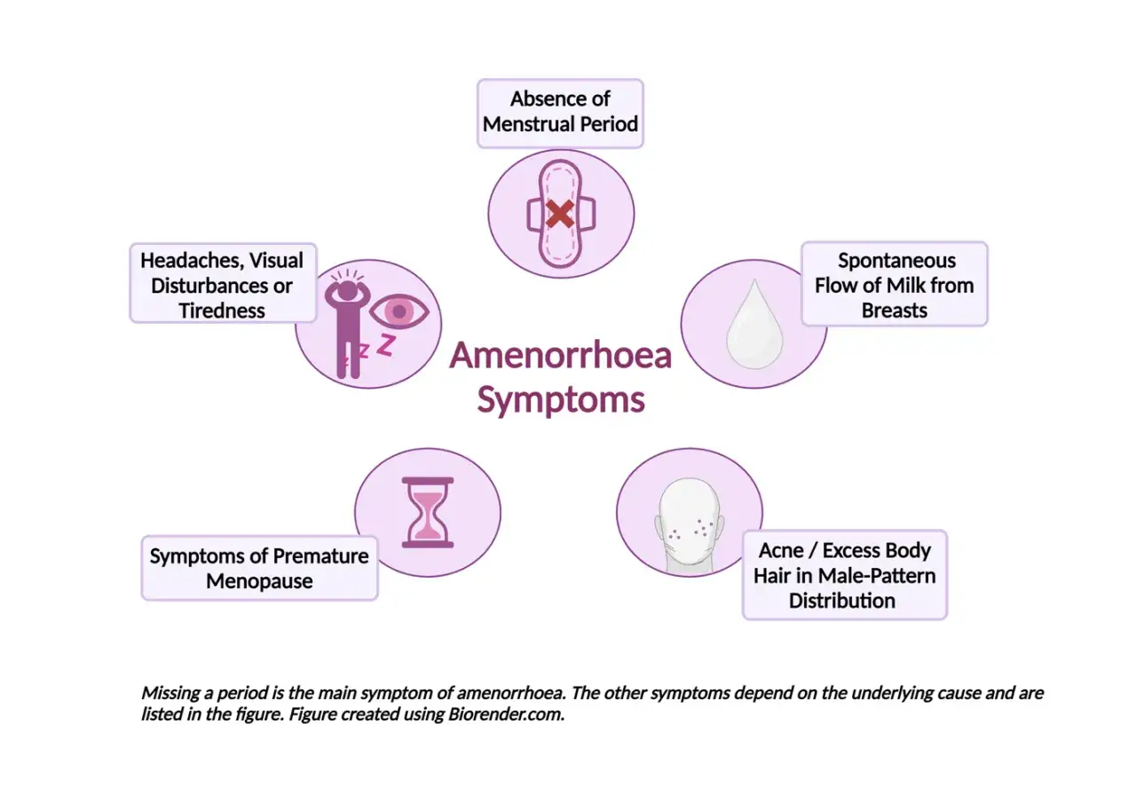 Sintomi di amenorrea ipotalamica: assenza di ciclo, mal di testa, stanchezza, galattorrea, acne, peli in eccesso e menopausa precoce.