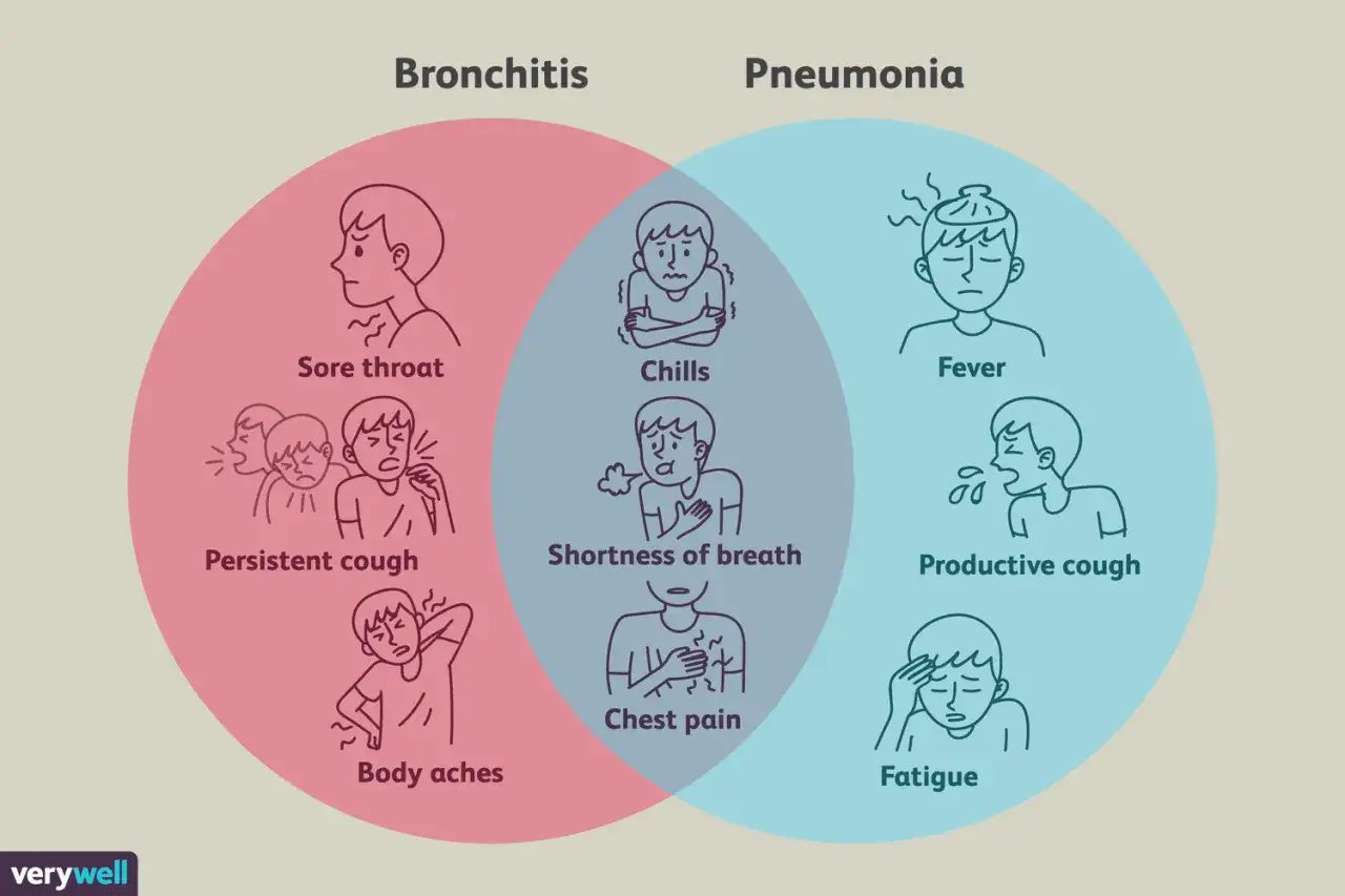 Diagramma di Venn che confronta bronchite e polmonite, con sintomi come mal di gola, tosse persistente e dolori corporei per la bronchite. L'antibiotico per bronchite è spesso necessario.
