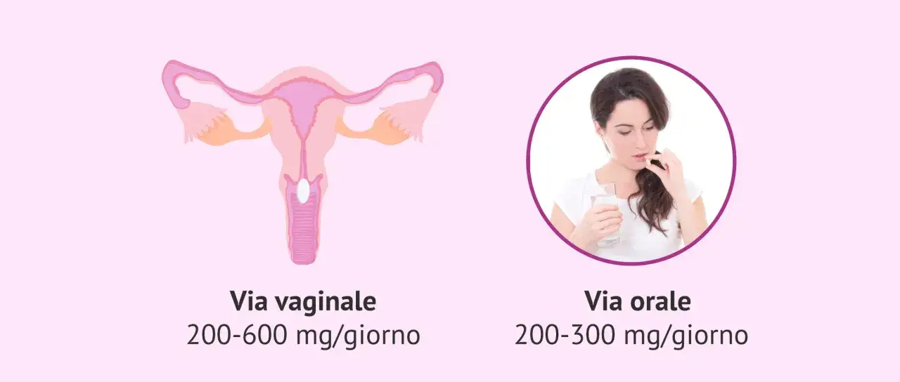 Utero con ovulo inserito e donna che prende una pillola. Possibili perdite bianche dopo ovuli.