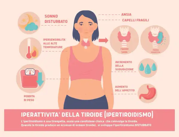 Sintomi tiroide nelle donne: sonno disturbato, ansia, perdita di peso, sudorazione, aumento appetito, ipersensibilità al caldo, capelli fragili.