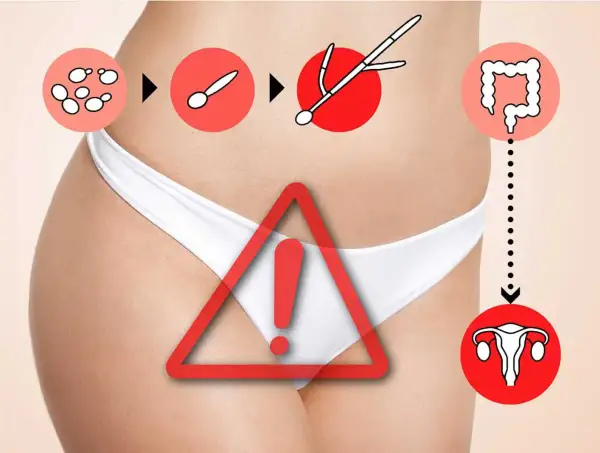 Illustrazione di un processo che porta a problemi ginecologici, con icone che suggeriscono la proliferazione di funghi e un avvertimento. Possibili sintomi di candida intestinale.